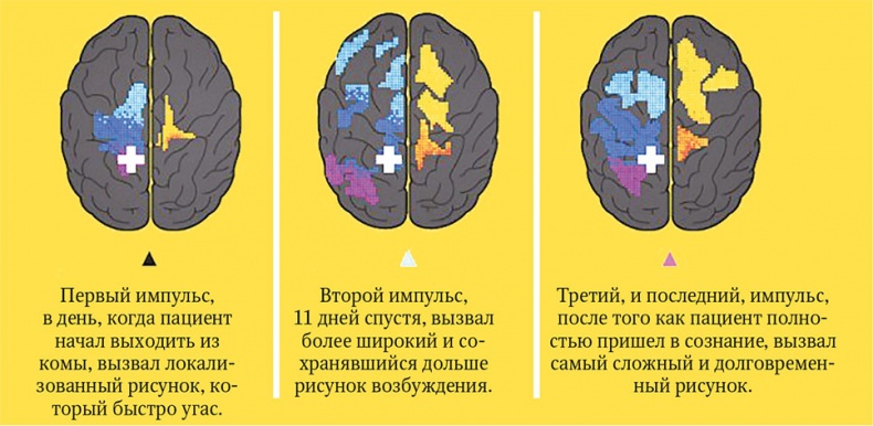 Мозг. Ваша личная история