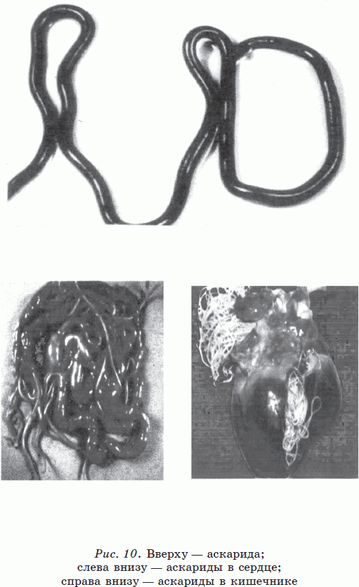 Иллюстрация к книге — Новые тайны нераспознанных диагнозов. Книга 3 [_19.png]