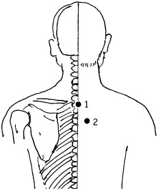 Иллюстрация к книге — Большой атлас целительных точек. Китайская медицина на страже здоровья и долголетия [_141.jpg]