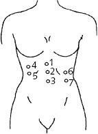 Иллюстрация к книге — Китайский императорский массаж. Лечение 100 болезней с помощью банок. Большой атлас зон исцеления [_10.jpg]