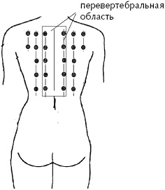 Иллюстрация к книге — Китайский императорский массаж. Лечение 100 болезней с помощью банок. Большой атлас зон исцеления [_19.jpg]