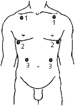 Иллюстрация к книге — Китайский императорский массаж. Лечение 100 болезней с помощью банок. Большой атлас зон исцеления [_24.jpg]