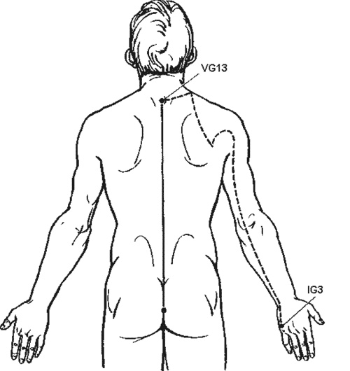 Иллюстрация к книге — Ипликатор Кузнецова. Избавление от боли в спине и шее [i_028.jpg]