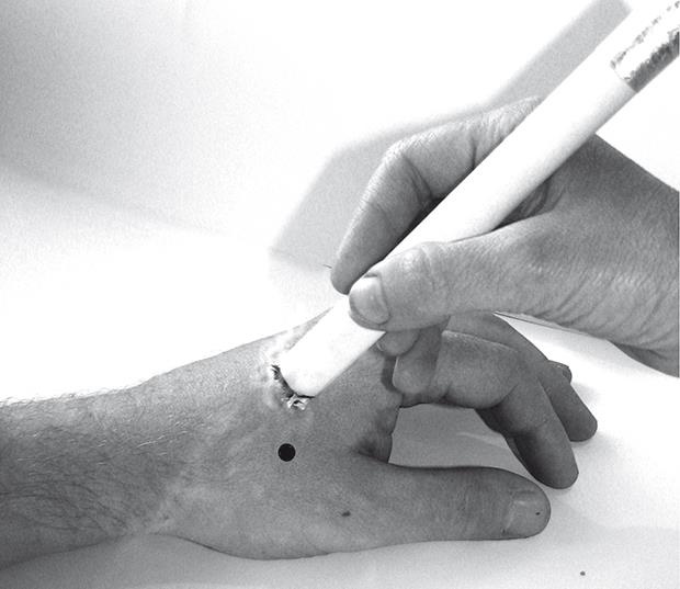 Иллюстрация к книге — Атлас целительных точек. Печень, почки, желудок [Autogen_eBook_id23.jpg]