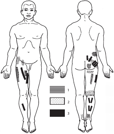 Иллюстрация к книге — Массаж. Уроки великого мастера [_126.jpg]