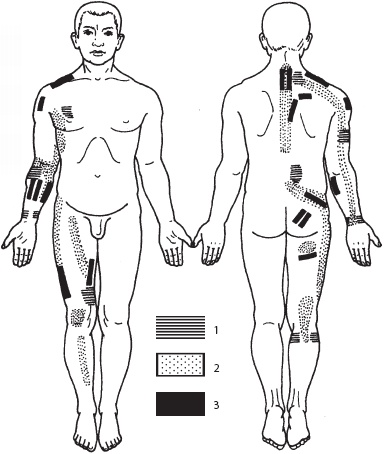Иллюстрация к книге — Массаж. Уроки великого мастера [_138.jpg]