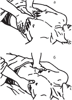 Иллюстрация к книге — Большой справочник по массажу [_122.jpg]