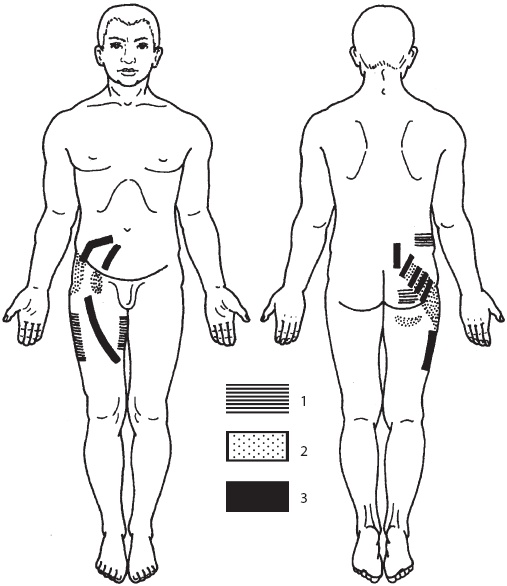 Иллюстрация к книге — Большой справочник по массажу [_130.jpg]