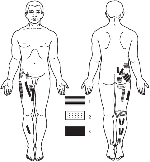 Иллюстрация к книге — Большой справочник по массажу [_131.jpg]