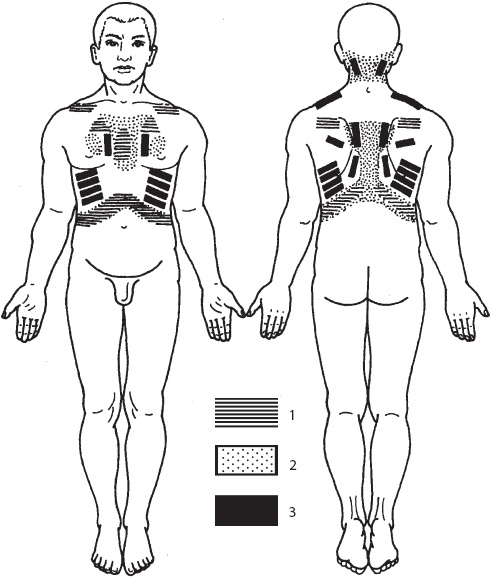 Иллюстрация к книге — Большой справочник по массажу [_148.jpg]