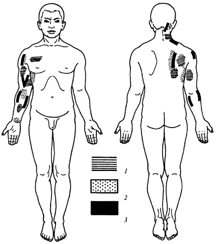 Иллюстрация к книге — Все про массаж [i_143.jpg]