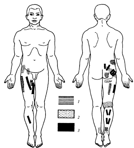 Иллюстрация к книге — Все про массаж [i_145.jpg]