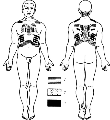 Иллюстрация к книге — Все про массаж [i_165.jpg]