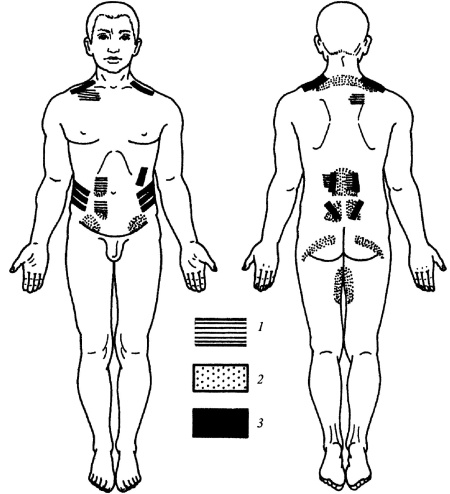 Иллюстрация к книге — Все про массаж [i_171.jpg]