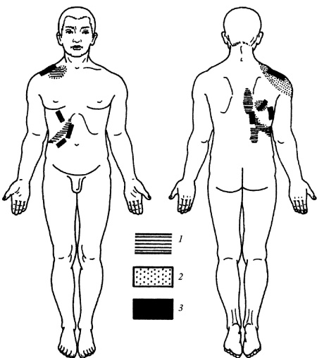 Иллюстрация к книге — Все про массаж [i_172.jpg]