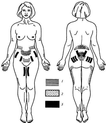 Иллюстрация к книге — Все про массаж [i_174.jpg]