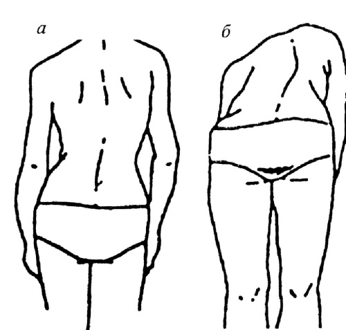 Иллюстрация к книге — Все про массаж [i_230.jpg]