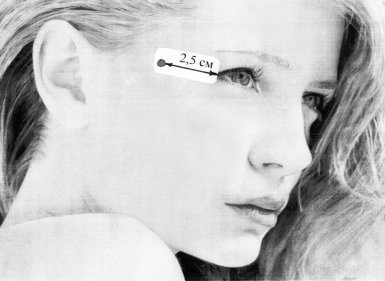 Иллюстрация к книге — Пиявки. Домашняя гирудотерапия [i_001.jpg]