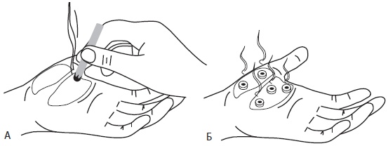 Иллюстрация к книге — Су-Джок. Самодиагностика и лечение [Autogen_eBook_id45.jpg]