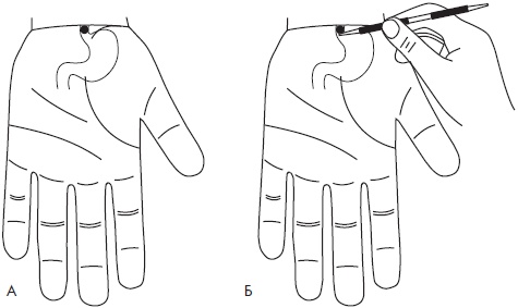 Иллюстрация к книге — Су-Джок. Самодиагностика и лечение [Autogen_eBook_id62.jpg]