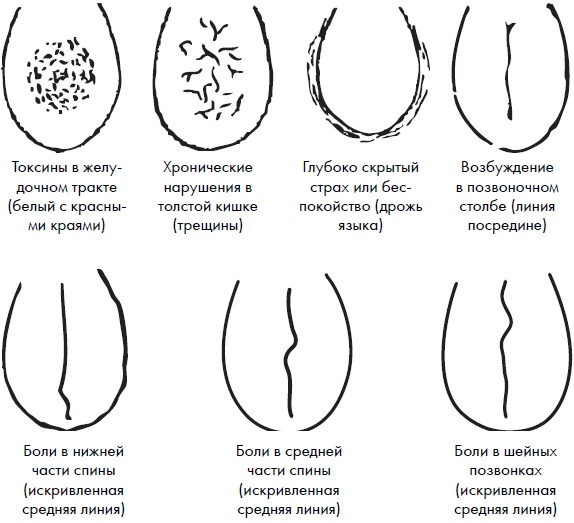 Иллюстрация к книге — Су-Джок. Самодиагностика и лечение [Autogen_eBook_id98.jpg]