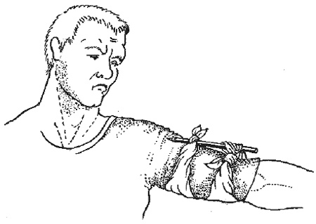Иллюстрация к книге — 1000 советов опытного доктора. Как помочь себе и близким в экстремальных ситуациях [i_018.jpg]