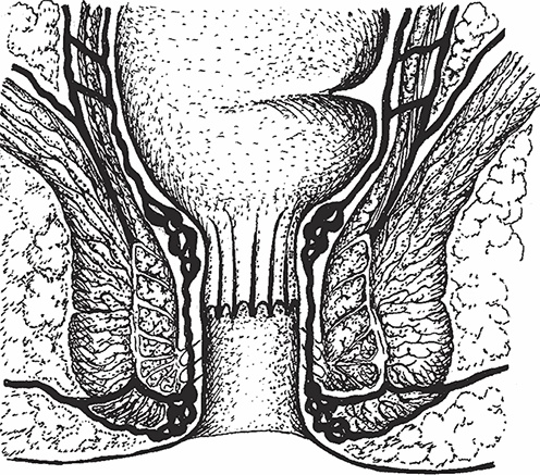 Иллюстрация к книге — Геморрой. Излечение без операции [i_004.jpg]