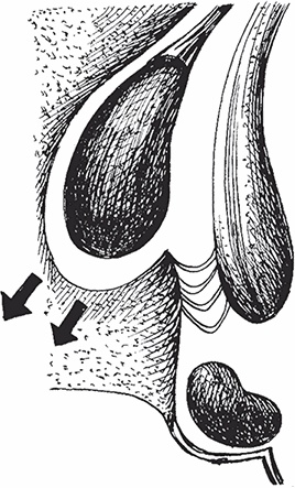 Иллюстрация к книге — Геморрой. Излечение без операции [i_007.jpg]