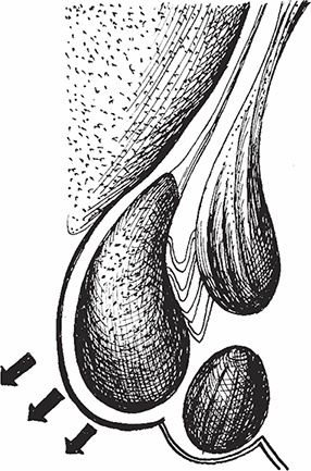 Иллюстрация к книге — Геморрой. Излечение без операции [i_010.jpg]