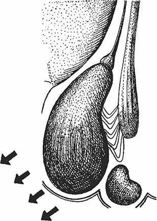 Иллюстрация к книге — Геморрой. Излечение без операции [i_011.jpg]