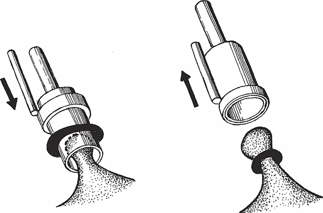 Иллюстрация к книге — Геморрой. Излечение без операции [i_016.jpg]