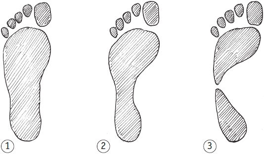 Иллюстрация к книге — Как избавиться от боли в суставах ног [i_097.jpg]