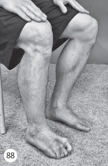 Иллюстрация к книге — Как избавиться от боли в суставах ног [i_101.jpg]