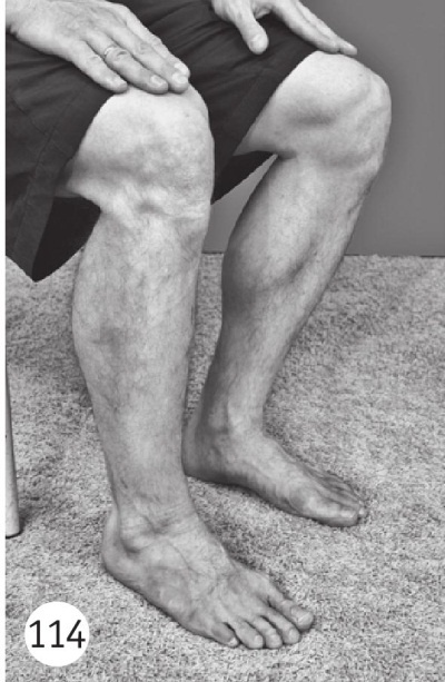 Иллюстрация к книге — Суставы без боли. Курс изометрической гимнастики [i_127.jpg]