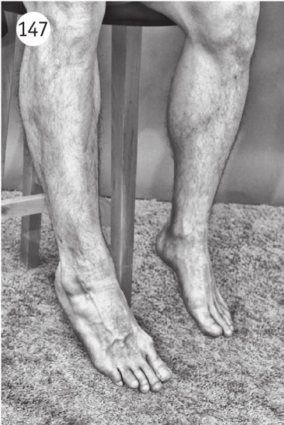 Иллюстрация к книге — Суставы без боли. Курс изометрической гимнастики [i_160.jpg]