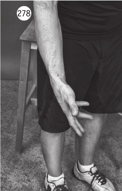 Иллюстрация к книге — Суставы без боли. Курс изометрической гимнастики [i_296.jpg]