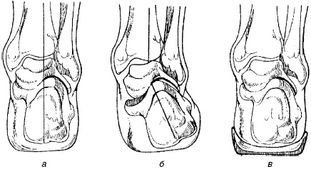 Иллюстрация к книге — Остеохондроз и плоскостопие у мужчин. Супермен и соломинка. Профилактика, диагностика, лечение [_13.jpg]