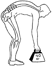 Иллюстрация к книге — Остеохондроз и плоскостопие у мужчин. Супермен и соломинка. Профилактика, диагностика, лечение [_8.jpg]