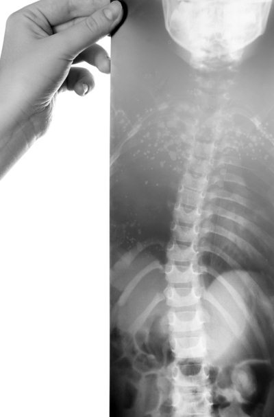 Иллюстрация к книге — Правильная осанка. Как спасти ребенка от сколиоза [i_004.jpg]