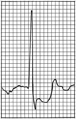 Иллюстрация к книге — Анализы и диагнозы. Это как же понимать? [_115.jpg]