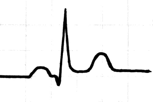 Иллюстрация к книге — Анализы и диагнозы. Это как же понимать? [_116.jpg]