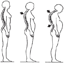 Иллюстрация к книге — Остеопороз. Тихая эпидемия XXI века [Autogen_eBook_id4.jpg]