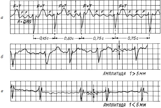Иллюстрация к книге — Полный медицинский справочник фельдшера [Autogen_eBook_id18.jpg]