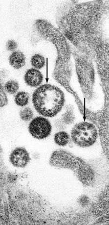 Иллюстрация к книге — Многоликий вирус. Тайны скрытых инфекций [i_008.jpg]