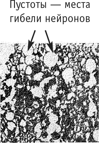 Иллюстрация к книге — Многоликий вирус. Тайны скрытых инфекций [i_018.jpg]