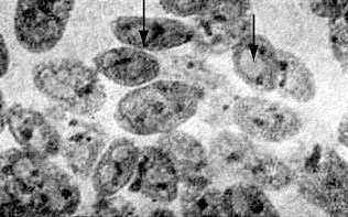 Иллюстрация к книге — Многоликий вирус. Тайны скрытых инфекций [i_022.jpg]