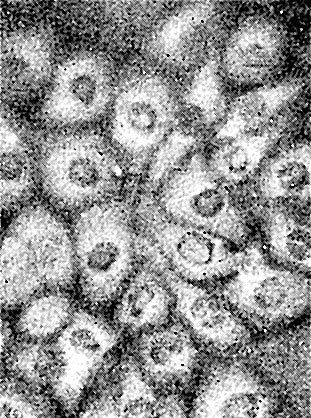 Иллюстрация к книге — Многоликий вирус. Тайны скрытых инфекций [i_031.jpg]