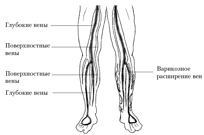 Иллюстрация к книге — Варикозное расширение вен. Лечение традиционными и нетрадиционными методами [_00_1.jpg]