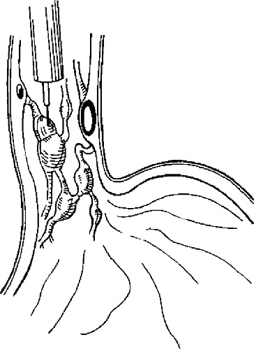 Иллюстрация к книге — Варикозное расширение вен. Лечение традиционными и нетрадиционными методами [_03.jpg]