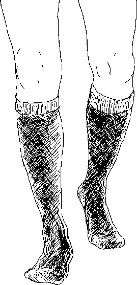 Иллюстрация к книге — Варикозное расширение вен. Лечение традиционными и нетрадиционными методами [_04.jpg]